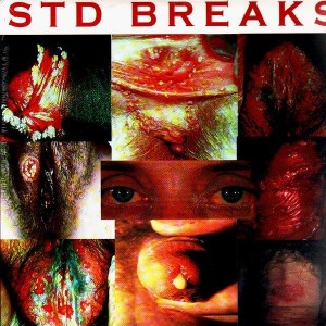 D-Styles - STD Breaks - LP